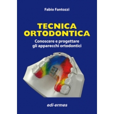 Fantozzi : tecnica ortodontica