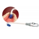 Total Comfort Cannula Trasparente Tappino Blu 100pz