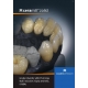Ceramill Zolid PS2 71XS H18mm 1pz
