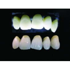 Nuance 750 Dentina A1