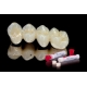 Ips Inline Pom Ingot Xs 1  -5pz