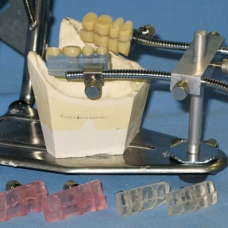 TPG Teeth Placement Guide Set