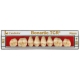Tcr Bonartic Resina, Post. Sup., Col.B3, Forma 04