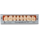 Condyloform Ceramica, Post. Sup., Col.M2, Forma 37